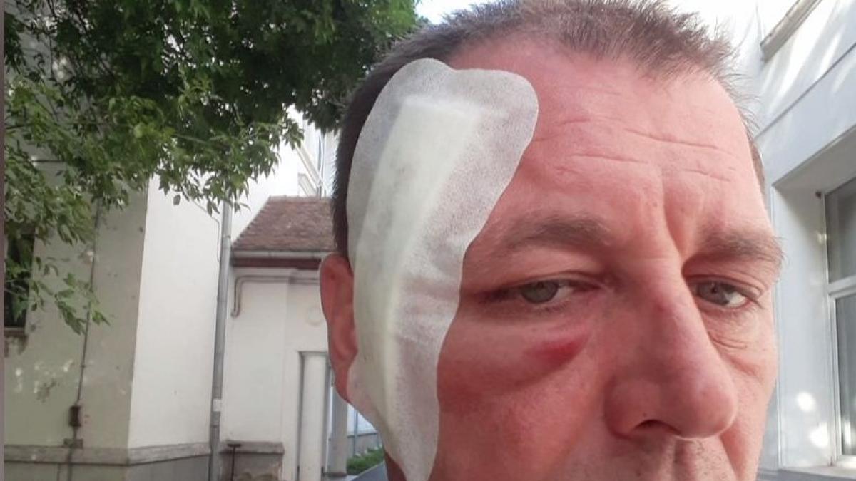 imagini socante cu jandarmii batuti la protestele din piata victoriei