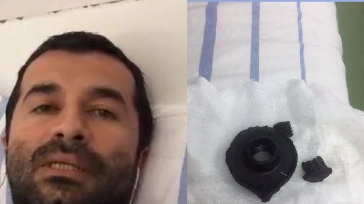 barbatul lovit la protestele din piata victoriei acuza jandarmii ca mint nu am fost avertizati