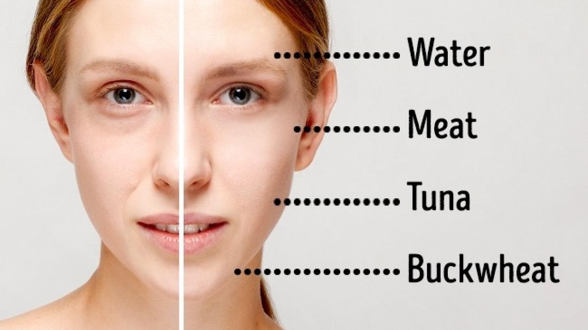 te trezesti cu cercuri negre si pungi sub ochi schimba ti alimentatia