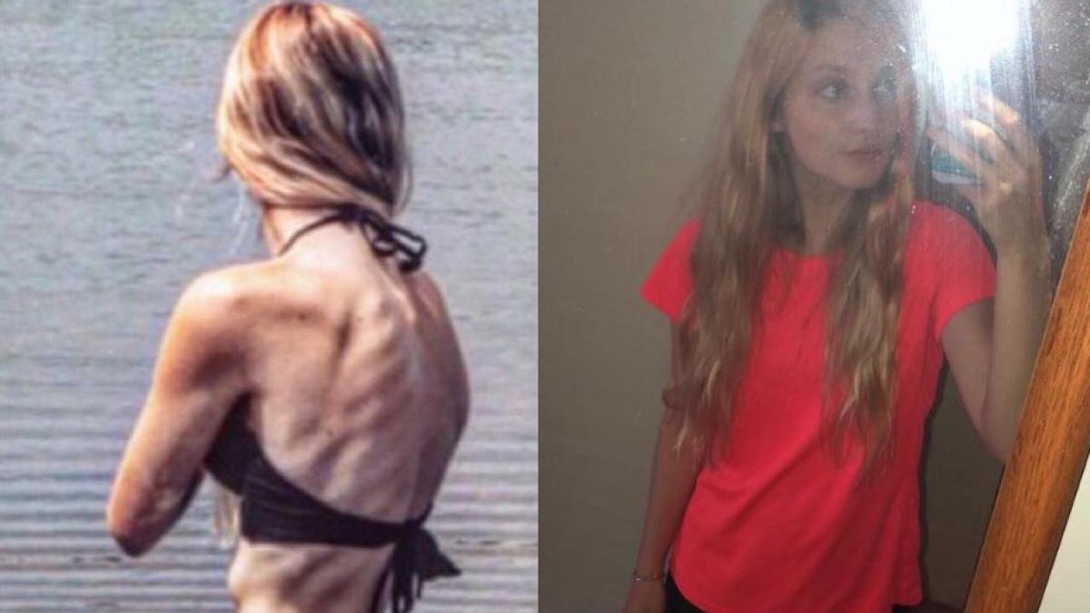 manca un mar pe zi si ajunsese la 33 de kilograme cum arata tanara