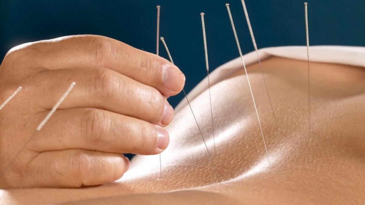 acupunctura tine departe medicamentele