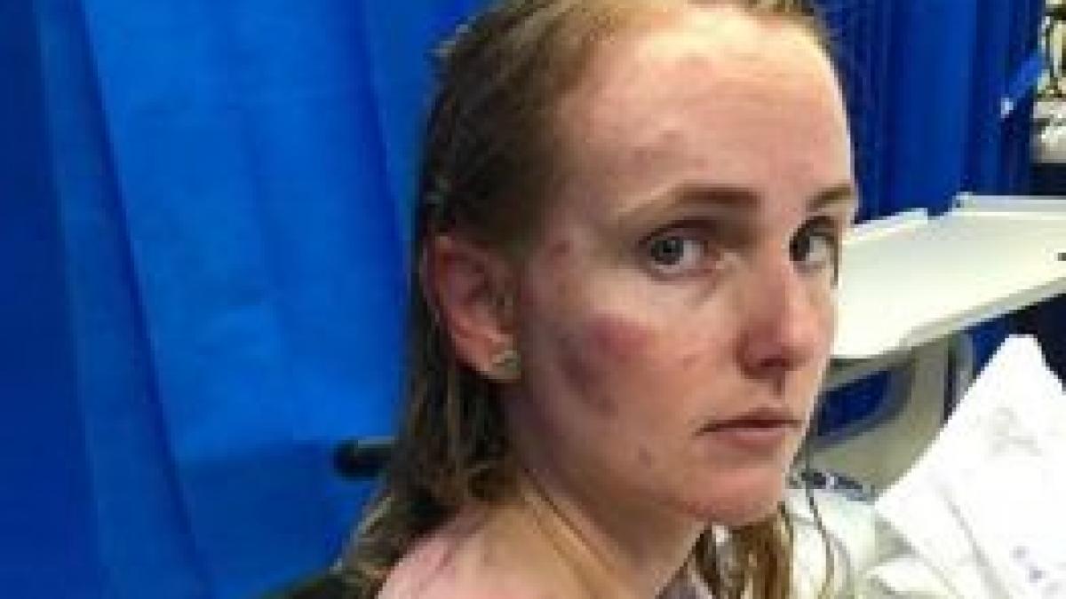 curajul unei mame depaseste imaginatia oricui ce a putut face ca sa si salveze fiica