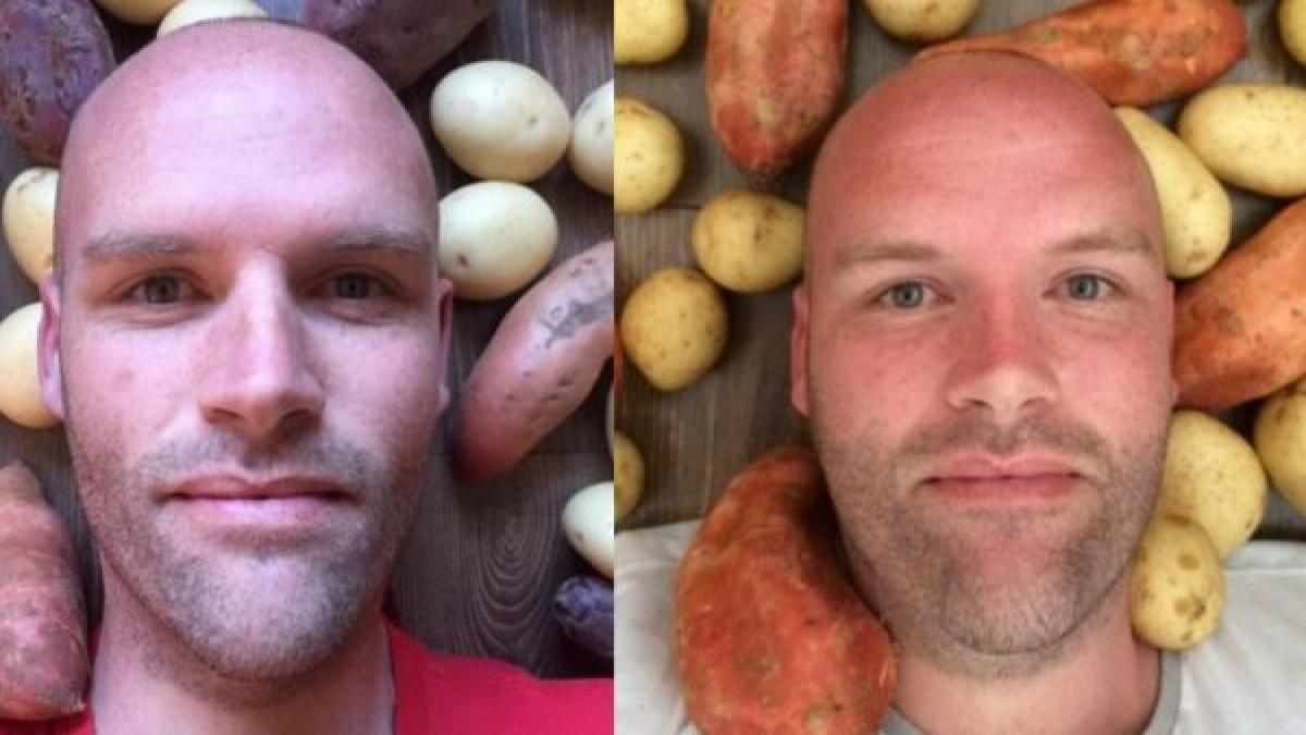 barbatul asta a mancat doar cartofi timp de un an uite ce i s a intamplat la finalul dietei