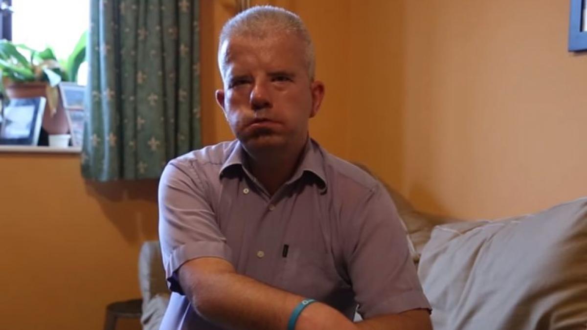 povestea impresionanta a unui cuplu care nu poate zambi din cauza unei conditii rare de care sufera