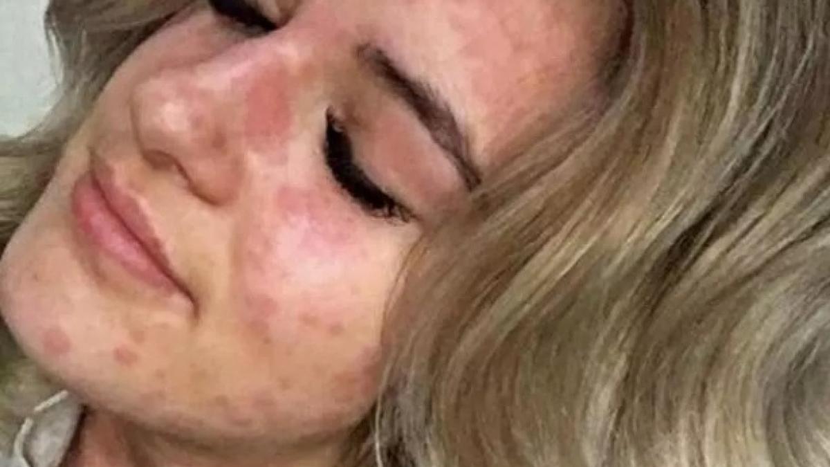 povestea tinerei care este alergica la frig cosmarul prin care trece cand iese din casa unii medici