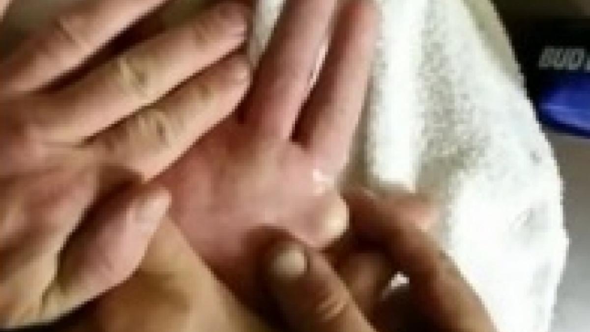 prietenul lor dormea iar ei i au spart chistul de pe mana s au crucit cand au vazut ce a iesit de