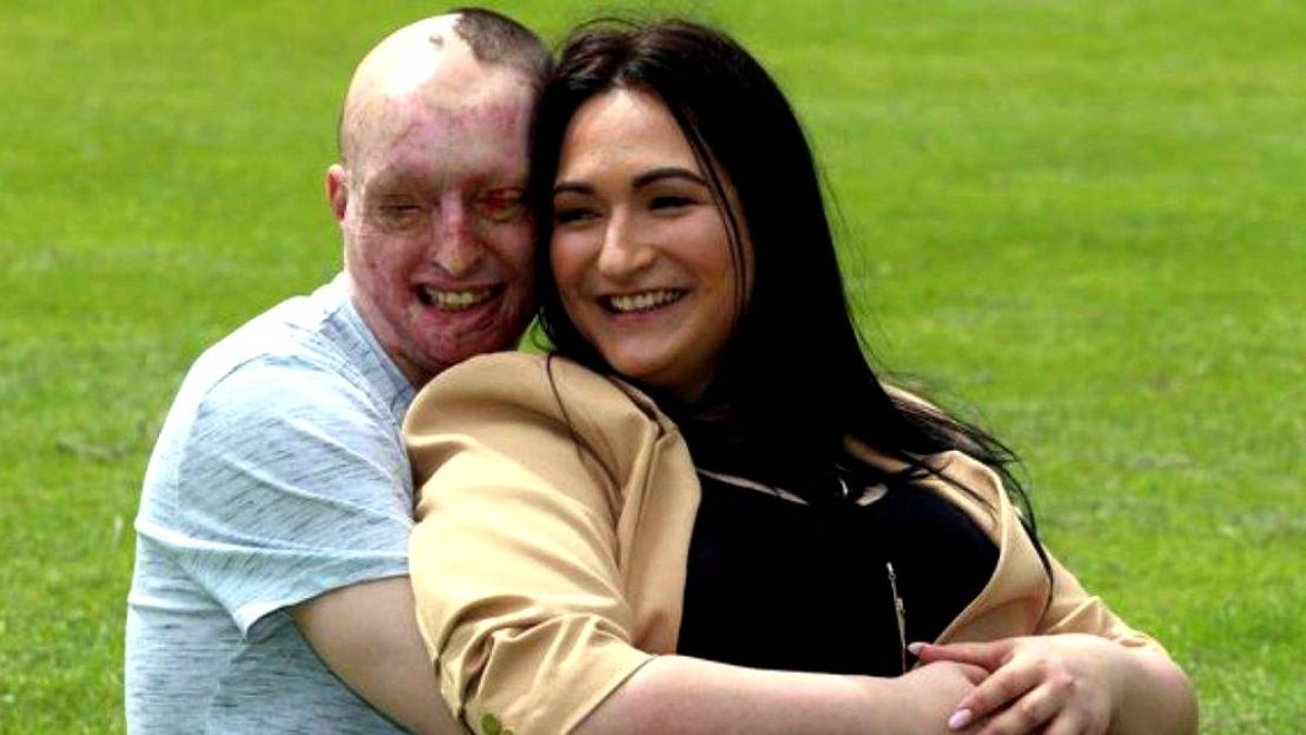 fosta logodnica l a desfigurat dupa ce i a turnat acid pe fata romanul ramasese fara sperante dar