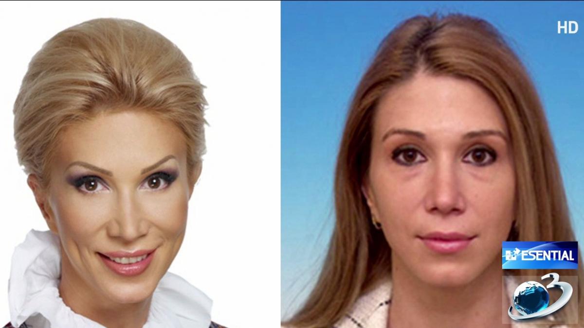 aparitii dezastruoase ale politicienilor fotografii inainte si dupa operatiile estetice video