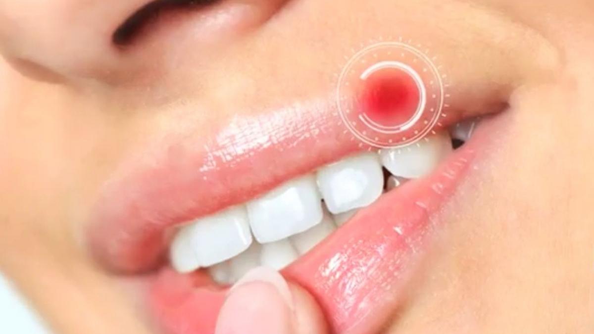 numai de bine virusul care ne ramane in corp toata viata