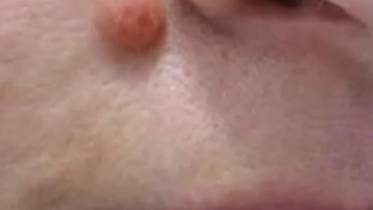 avea un neg mare si urat langa nas e incredibil cum a reusit sa scape de el singura acasa in doar