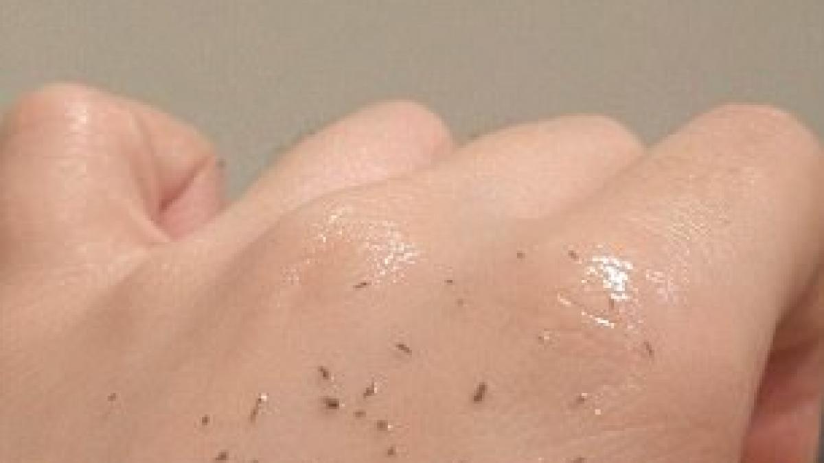 metoda controversata care scoate toate punctele negre din piele este incredibil ce trebuie sa faci