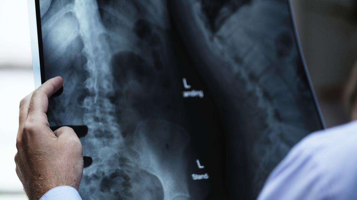 descoperire surprinzatoare despre corpul uman ce au observat cercetatorii in interiorul oaselor