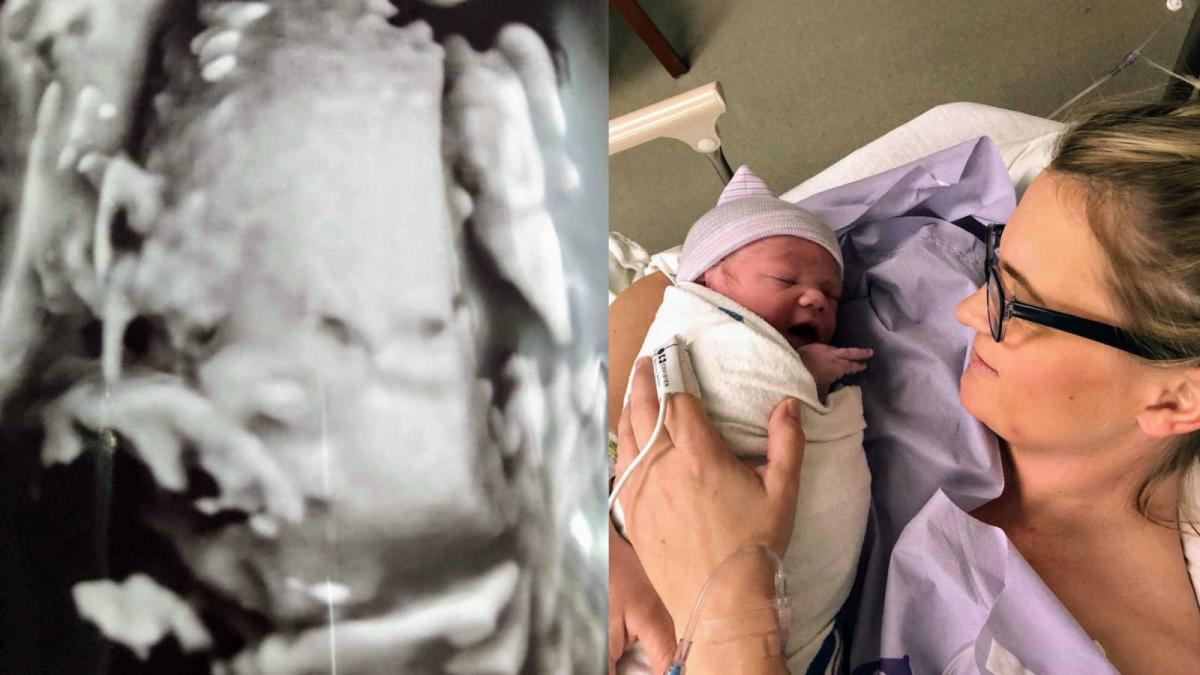 era gravida si medicii i au spus sa renunte la sarcina in fiecare saptamana ce decizie sfasietoare