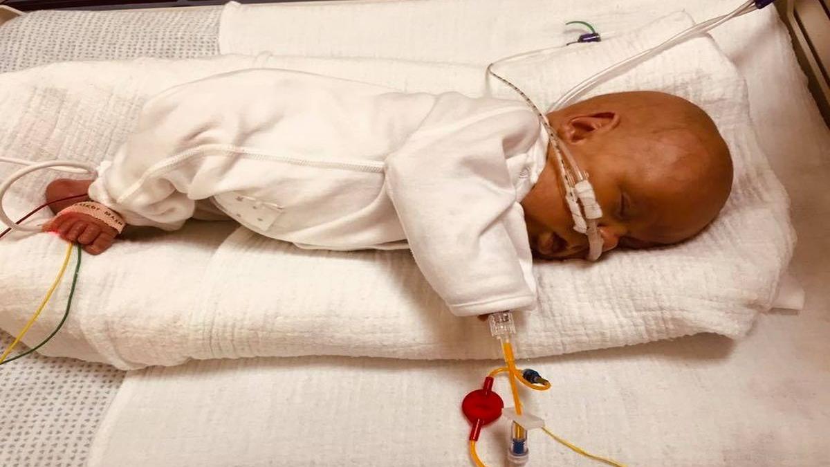 un bebelus nascut cu trei luni mai devreme de termen a supravietuit in ciuda avertizarilor date de