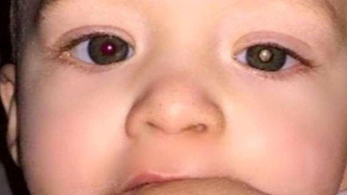 a observat ceva ciudat in poza facuta copilului a mers la medic si a primit o veste socanta