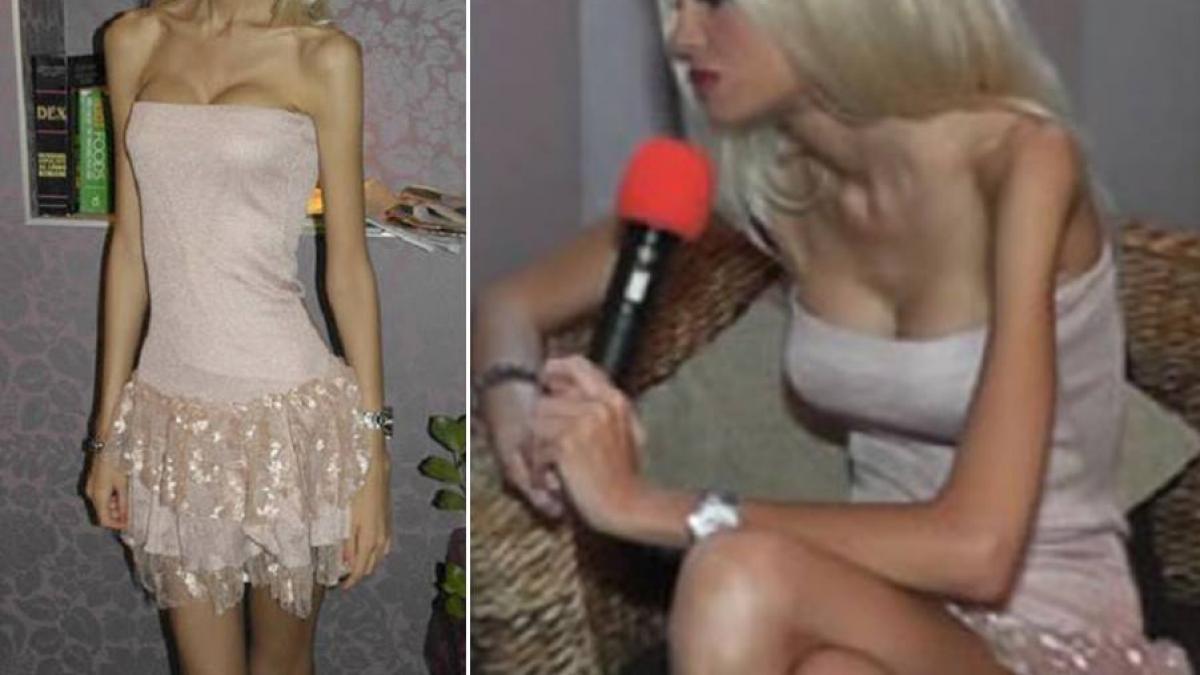 o mai tii minte pe flavia in 2013 era cea mai anorexica femeie si cantarea 35 de kilograme acum