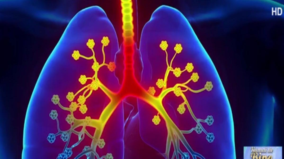 numai de bine astmul afectiunea care afecteaza 1 milion de romani