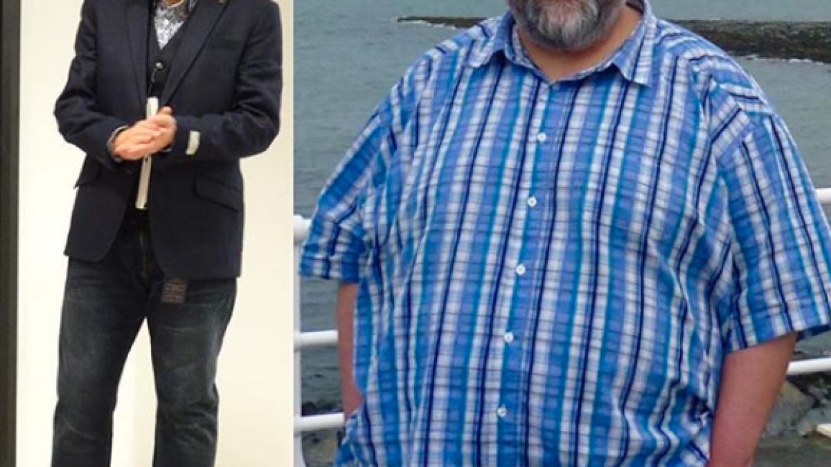 un barbat a reusit sa slabeasca 127 de kilograme in doar doi ani fara operatii sau pastile facand