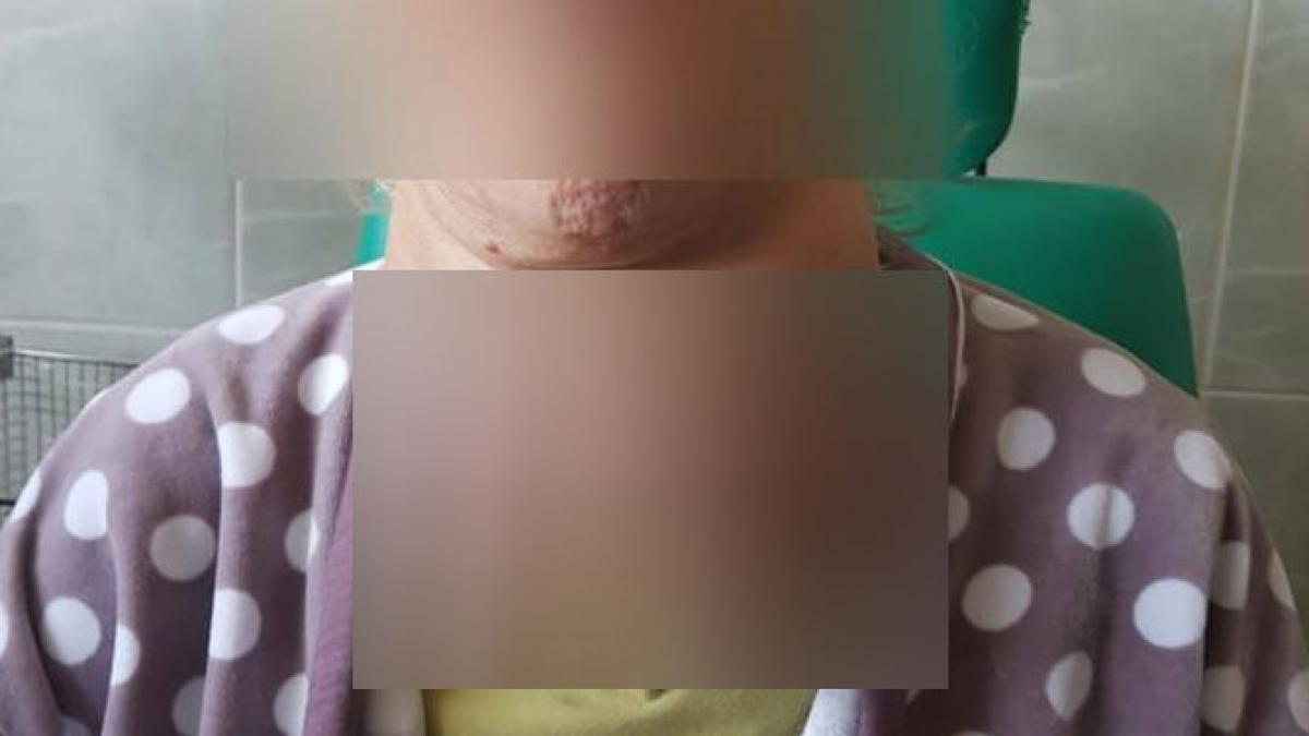 e fumatoare avea o gusa voluminoasa si ragusise de abia mai vorbea medicii de la spitalul