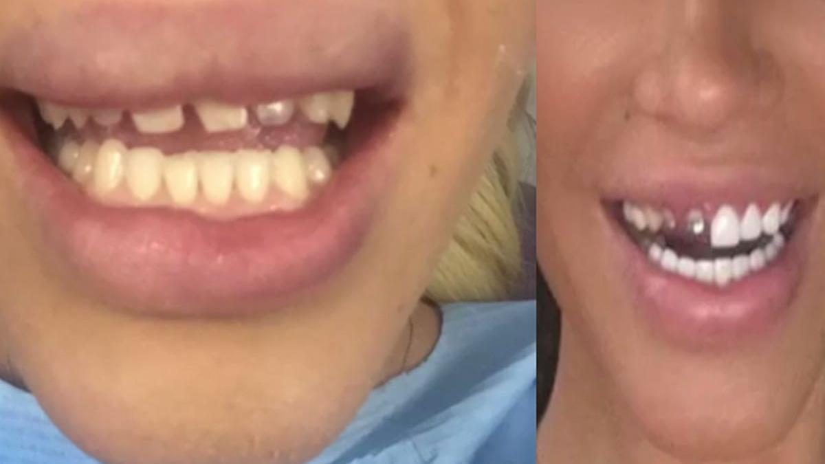 o vedeta de la noi are probleme de sanatate grave si a lipit dintii cu super glue