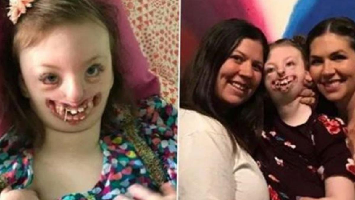 sophia fetita desfigurata de boala rett si pe care unii internauti au batjocorit o a murit la