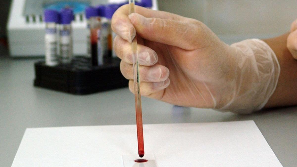 atentie aceasta boala foarte parsiva nu da simptome decat atunci cand incepe sa te manance pe