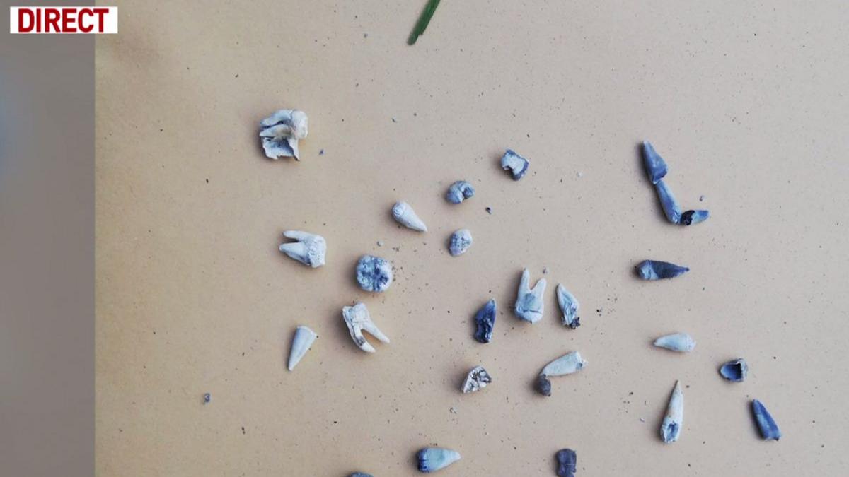 asa arata resturile de oase si dintii pe care le au gasit politistii in curtea suspectului in cazul