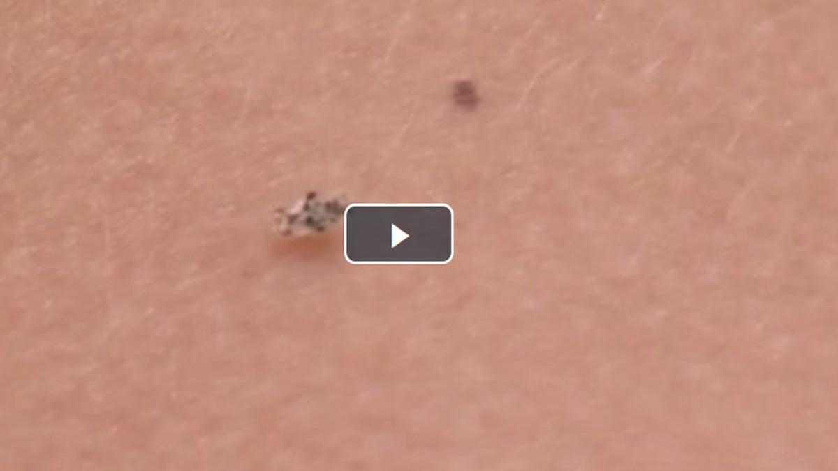 tigrul platanului o insecta de doar trei milimetri a invadat aproape toata tara video