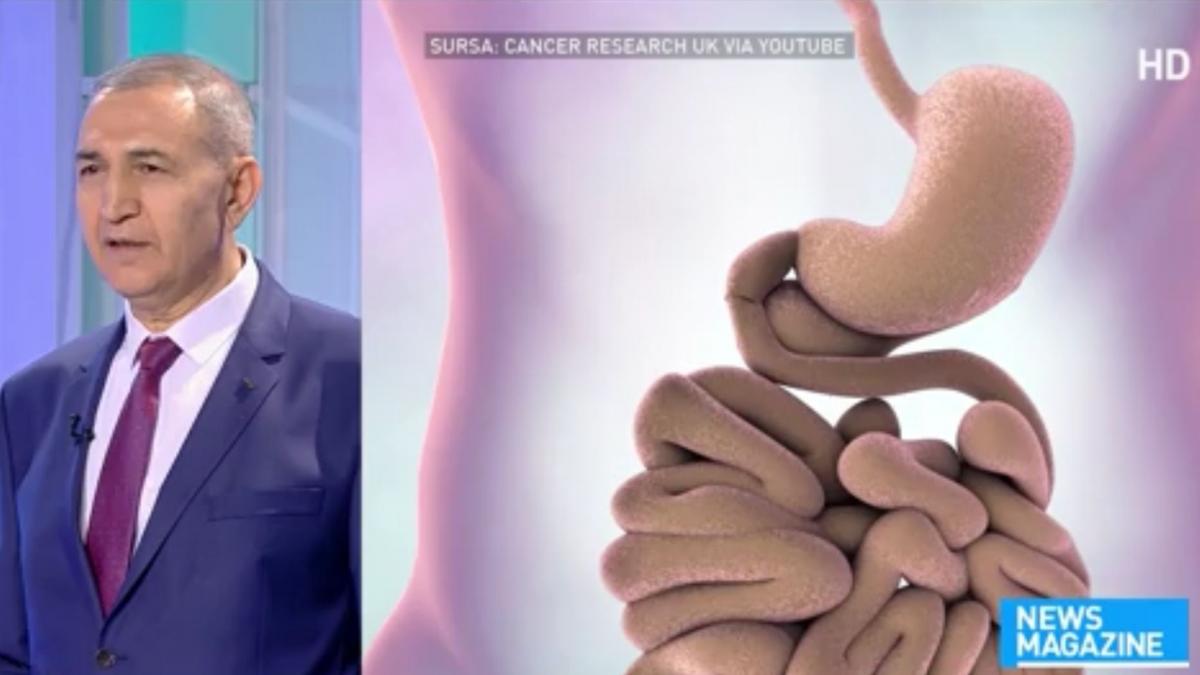 teste gratuite in bucuresti pentru depistarea cancerului colorectal