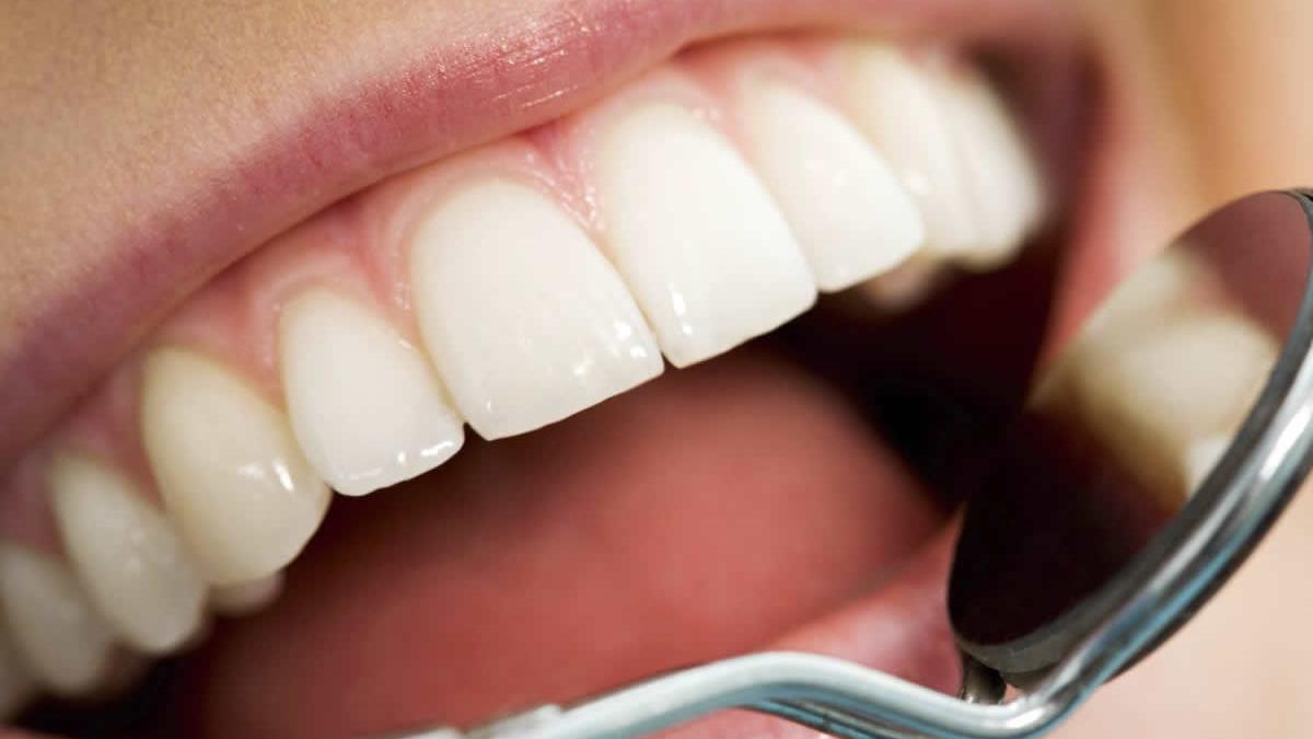 romanii ar putea da bani mai putini pe dentist cnas vrea sa dubleze plafonul de decontare a