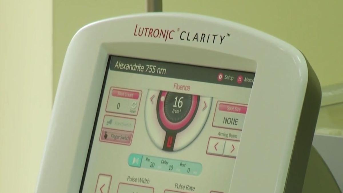 numai de bine care sunt beneficiile epilarii definitive