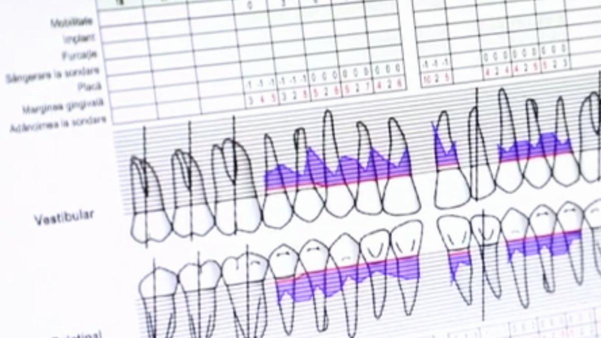 numai de bine ce trebuie sa stii despre boala parodontala