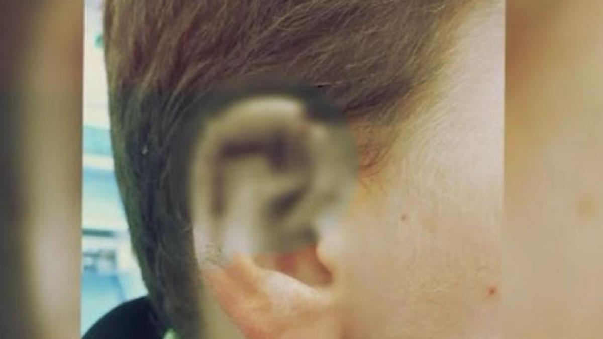 incident grav la o scoala din bucuresti un baietel a cazut si si a sectionat urechea insa nimeni nu