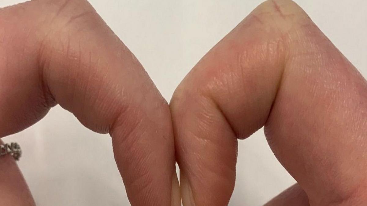 testul banal care iti arata daca suferi de cancer priveste cu atentie daca ai spatiul acesta intre