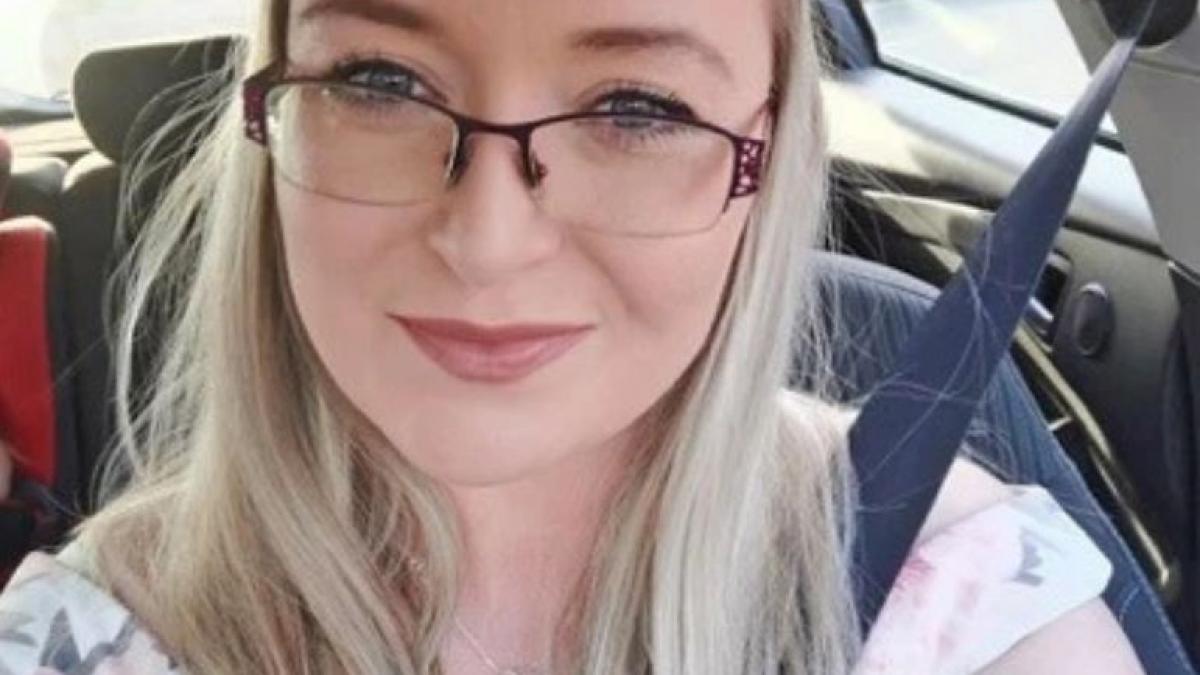 vopseaua de par aproape a ucis o era atat de deformata incat arata precum un extraterestru medicii