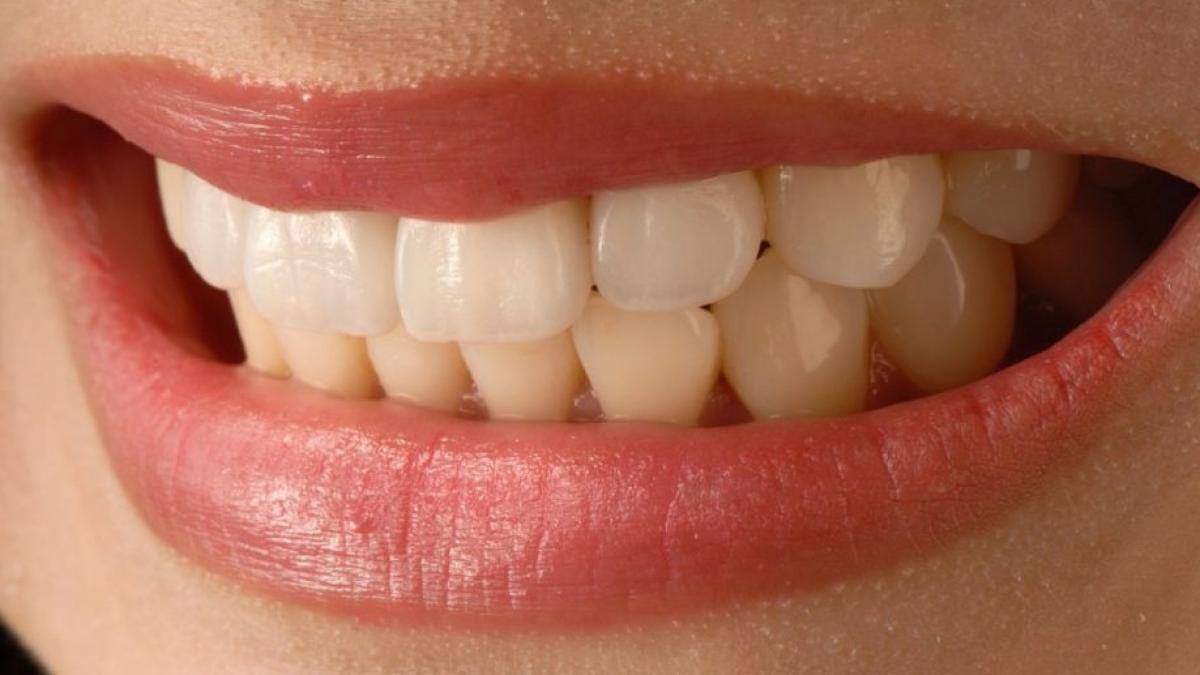 sfat de sanatate inamicul nevazut al pierderii dintilor