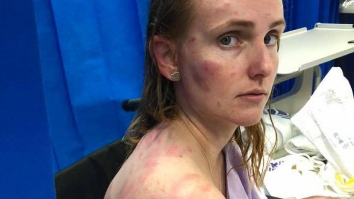 o mama a ajuns de urgenta la spital plina de vanatai cu fiica in brate imaginile sunt de a dreptul