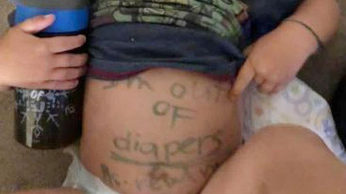 copil mazgalit pe burta cu carioca de educatoare mesajul lasat astfel a infuriat o pe mama care a