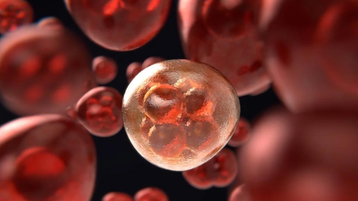 studiu 70 90 din toate cazurile de cancer au aceasta cauza