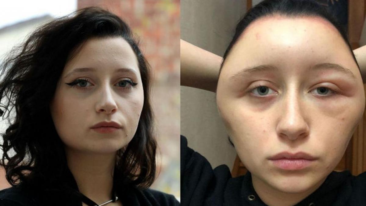 a fost la un pas de moarte din cauza unei greseli pe care aproape toate femeile o fac capul meu