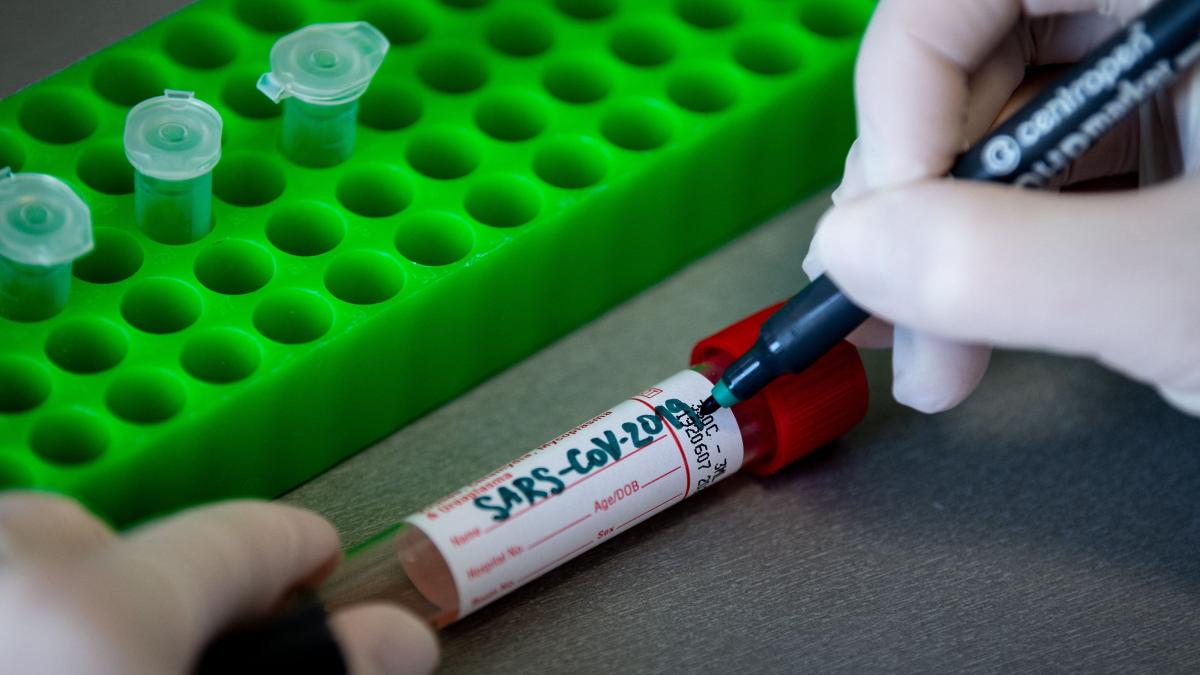 spania morti coronavirus bilant