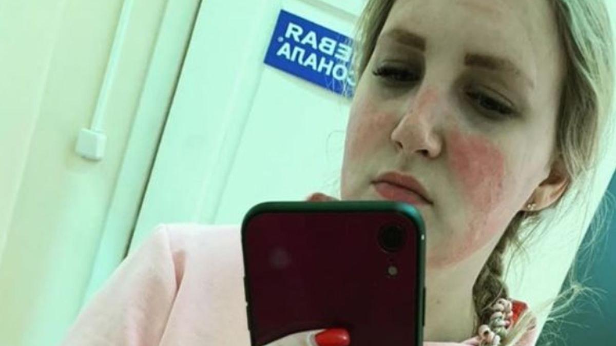 coronavirus masca protectie arsuri chimice