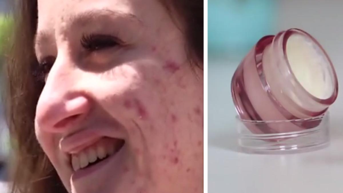 sute de tinere si au distrus tenul cu creme cumparate de pe internet recomandate de vedete