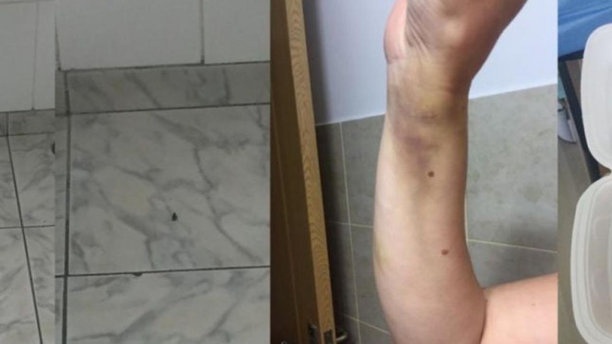 s a dus la spital muscata de o capusa dar a trait clipe de cosmar ma intrebam ce caut eu aici toata