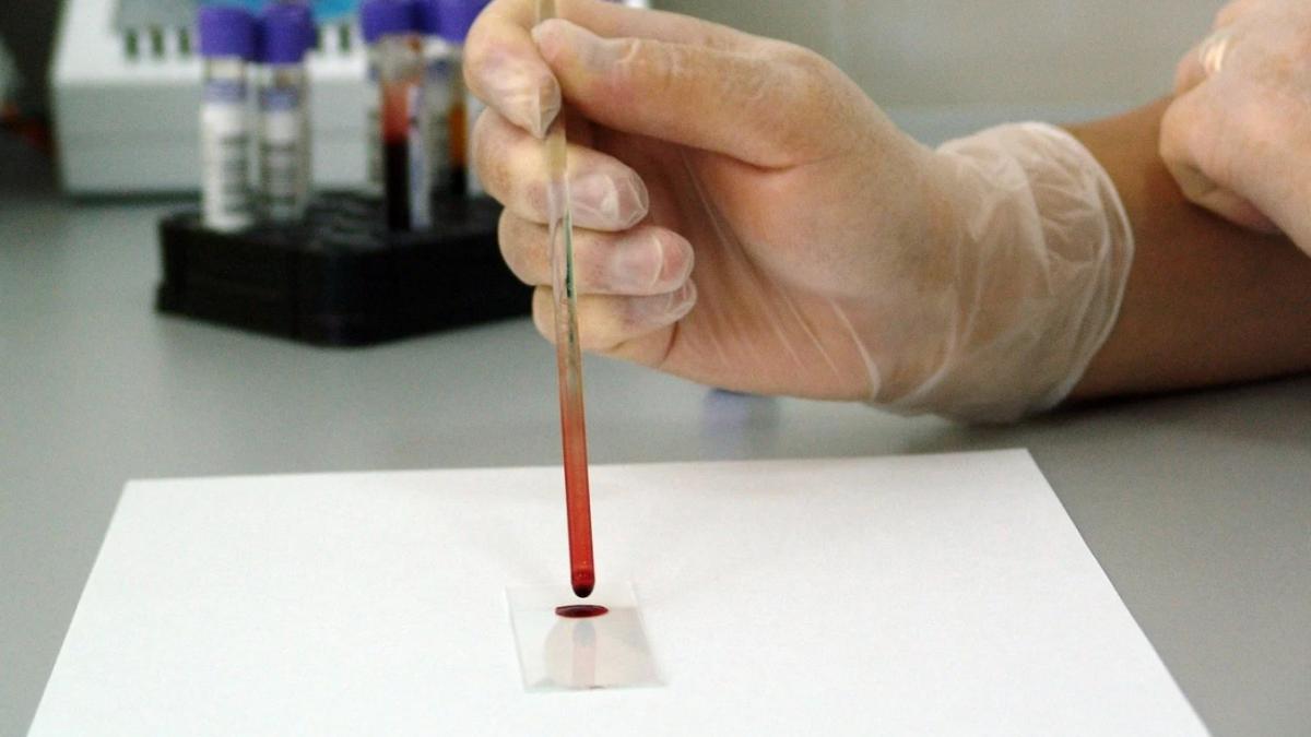 grupa de sange care ar avea un risc mai mare de a face cancer