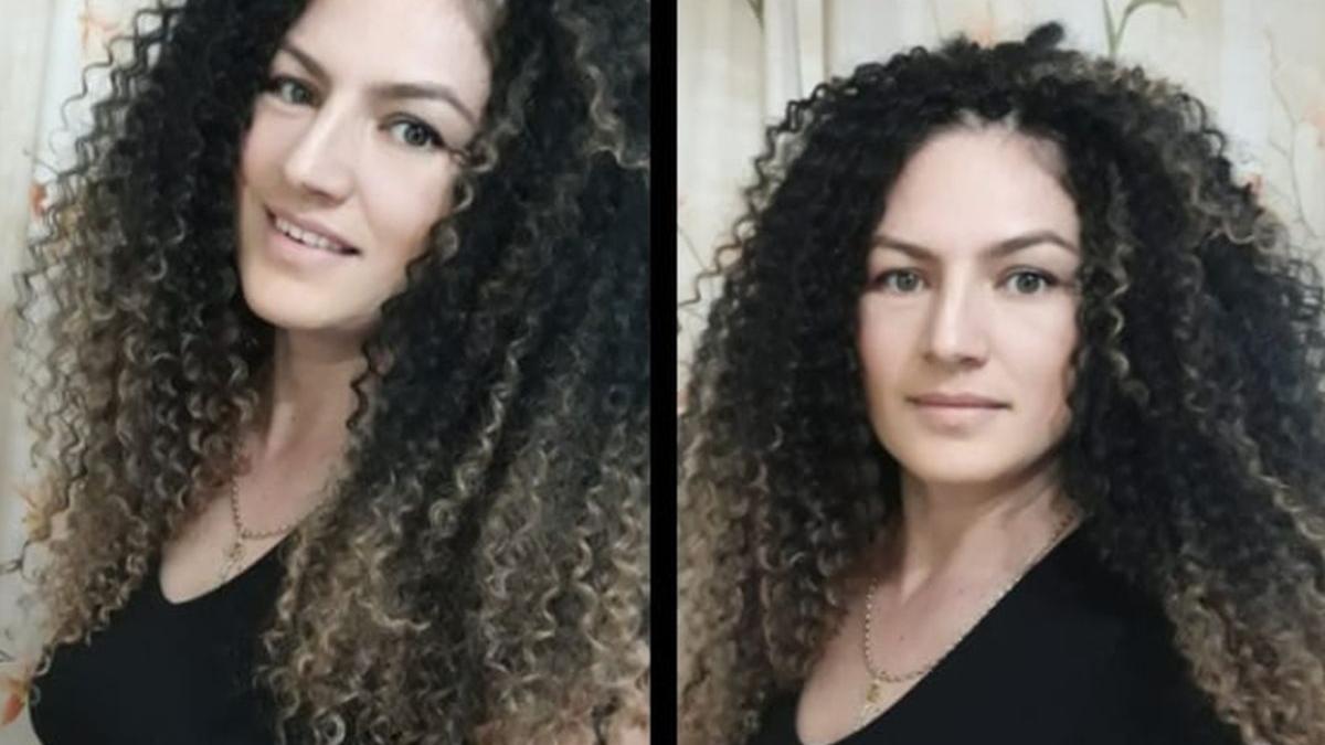 cum aratau plamanii femeii din alba care a murit de covid 19 desi nu avea nicio alta boala foto