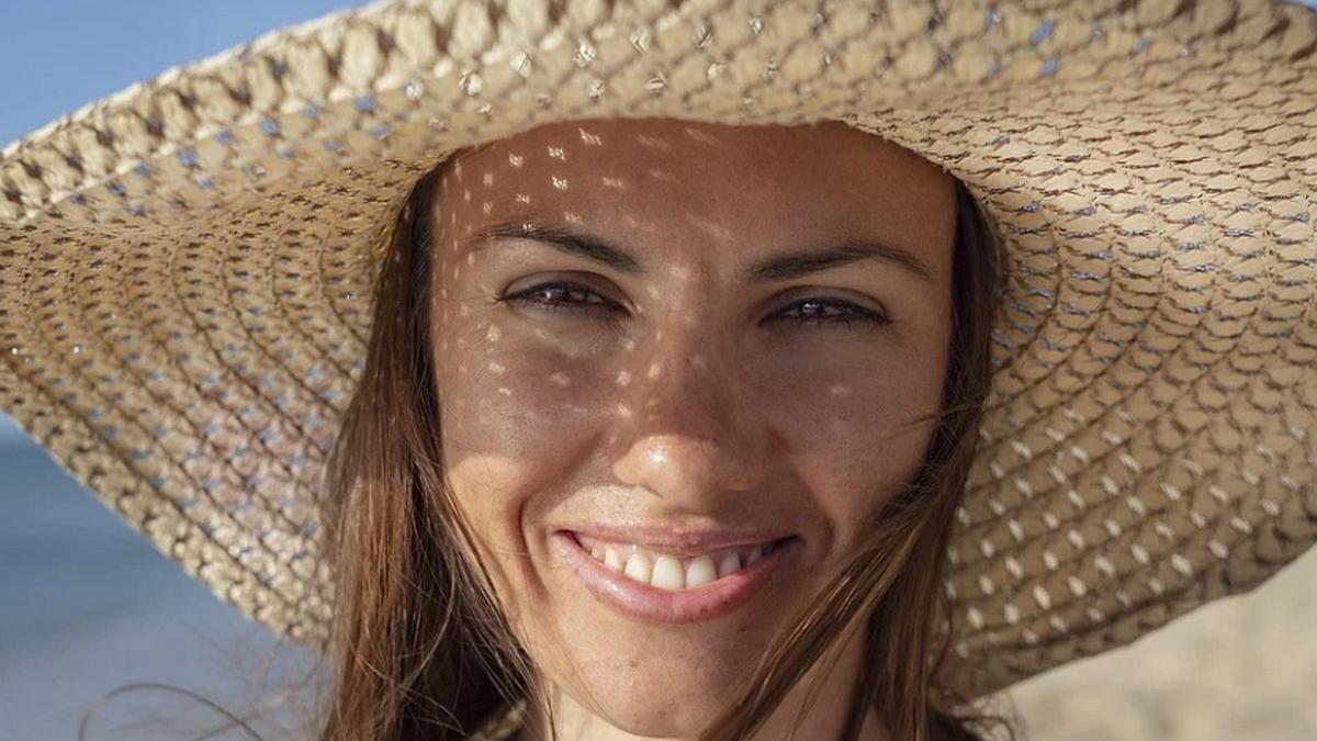 dr olga simionescu trage un semnal de alarma asupra pericolelor din cauza expunerii la soare se