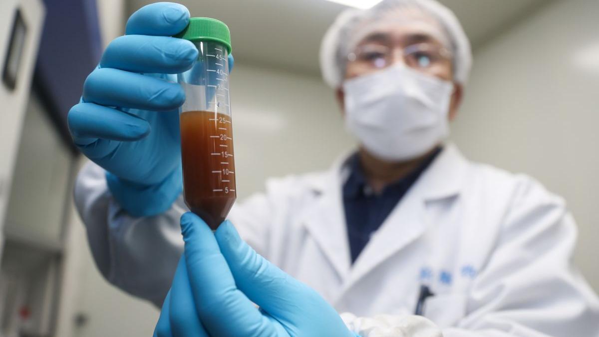 coronavirus in romania 18 august 2020 creste numarul romanilor au murit in ultimele 24 de ore