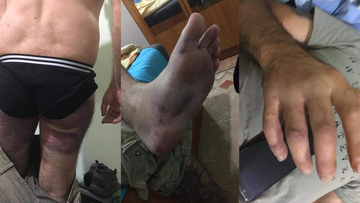 doi tineri acuza ca au fost torturati de politisti bucuresti