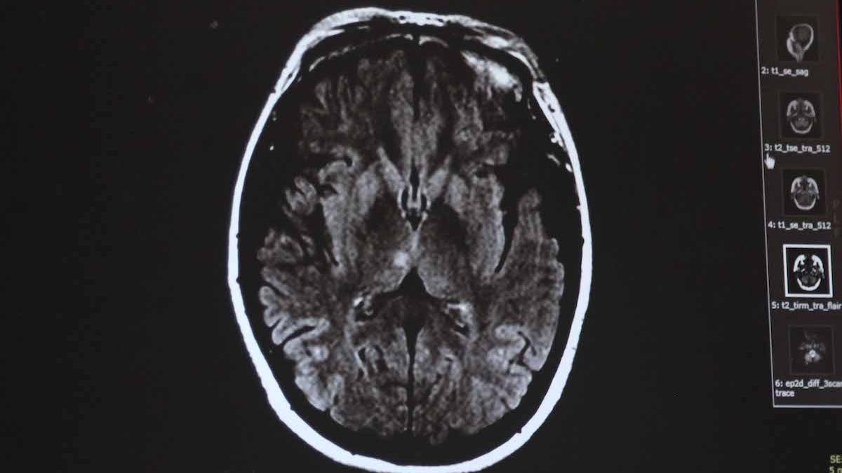 simptomele care te trimit urgent la medic fiecare minut conteaza cand suferi de aceasta afectiune